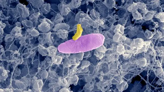 Бактерия Micavibrio aeruginosavorus (желтая) нападает на бактерию Pseudomonas aeruginosa (розовая)
