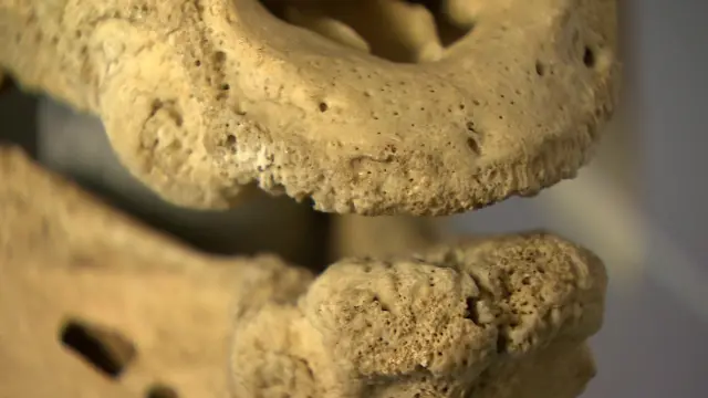 Челюсть Винни