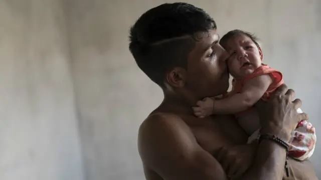 Brezilya Zika virüsünden en çok etkilenen ülke. 