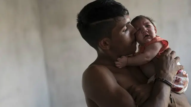 O Brasil tem 3.893 casos suspeitosmelhores sites de cassinomicrocefalia relacionada ao zika vírus 