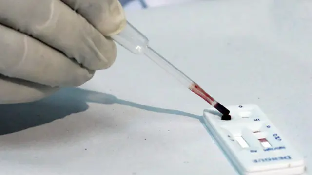 Test para detectar el virus zika