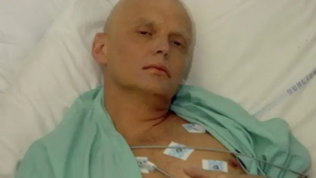 සක්‍රීය විකිරණ අඩංගු ප්ලූටෝනියම් විෂ ලිත්විනේන්කෝ ගේ ශරීරගතව තිබුණි 