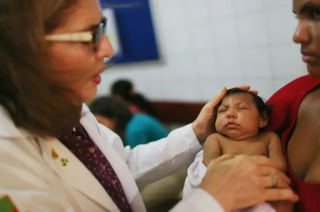 País tem quase 4 mil casosgolden gallina slotmicrocefalia notificados