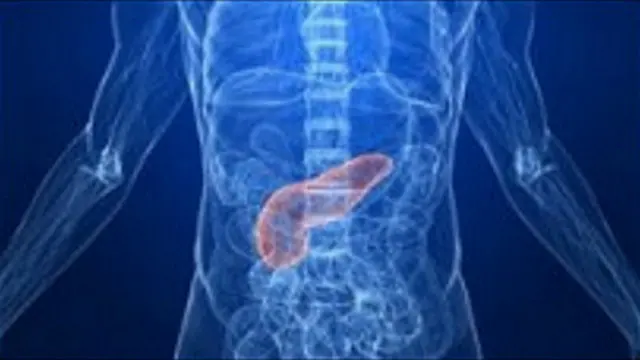 Sue York tidak bisa menyuntikkan insulin ke tubuhnya karena dia mengalami fobia jarum. Sehingga York menjalani transplantasi pankreas.