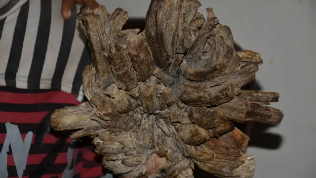 বলা হচ্ছে, বাংলাদেশে এই প্রথম কেউ এই রোগে আক্রান্ত হলো