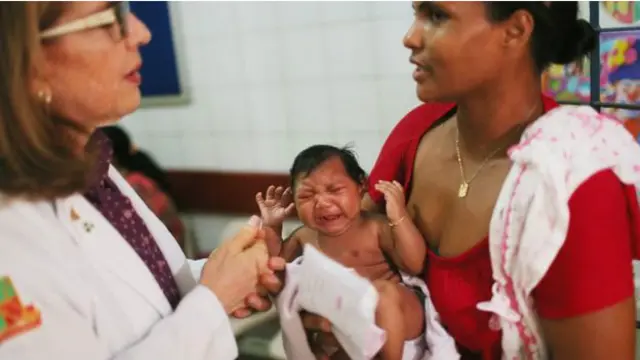 Virus Zika dikaitkan dengan berbagai penyimpangan bentuk dan fungsi otak ribuan bayi.
