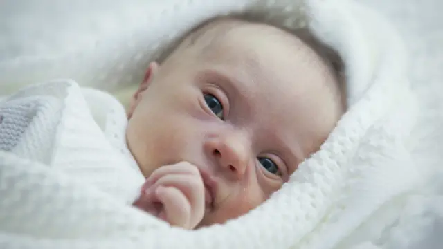 Bebé con síndrome de Down