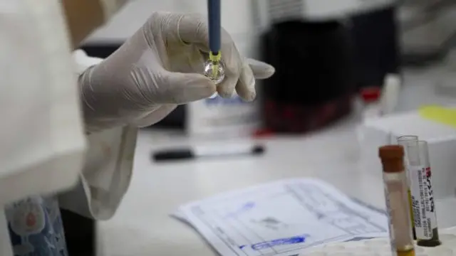 تاحال امریکہ میں مچھروں کے ذریعے زکا وائرس کے منتقل ہونے کے شواہد نہیں ملے