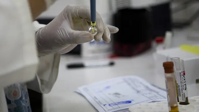 Kasus virus Zika yang ditularkan lewat hubungan seks ditemukan Pusat Pengendalian Penyakit (CDC) setelah menangani seorang pasien di Kota Dallas, Negara Bagian Texas.
