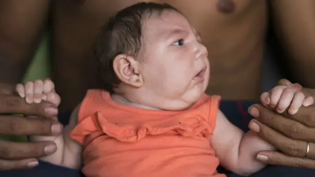 خدشہ ظاہر کیا جارہا ہے اس وائرس سے ہزاروں کی تعداد میں چھوٹے سر والے بچوں کی پیدائش ہورہی ہے