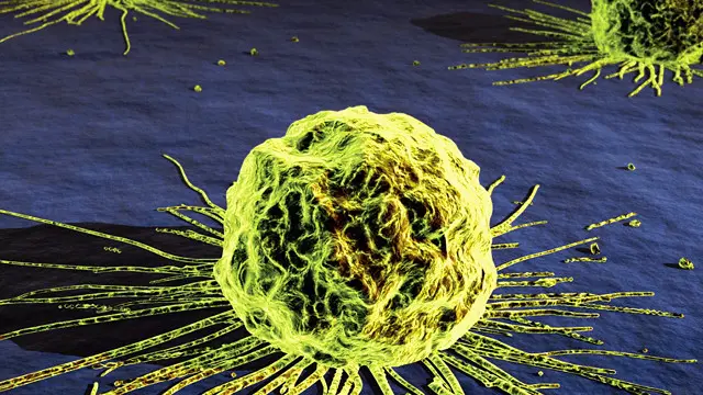 உகாண்டாவில் உள்ள கதிர்வீச்சு எந்திரம் பழுதானதால், நோயாளிகள் இனி கென்யாவுக்குச் செல்ல வேண்டும். 