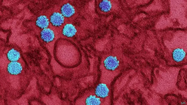 ज़ीका वायरस