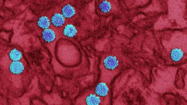 وائرس کی درجہ بندی کے بعد پتہ چلا ہے کہ یہ ایشیائی نسل کے ہیں جو امریکہ سے افریقہ پہنچے ہیں