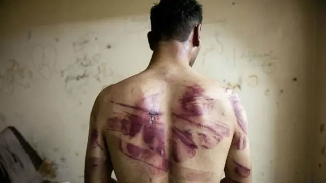 ညှဉ်းပမ်းမှုတွေ၊ ရောဂါဘယတွေ၊ ဥပဒေမဲ့ ကွပ်မျက်မှု တွေကြောင့် ဆီးရီးယားမှာ အကျဉ်းသား များစွာ သေဆုံးခဲ့ရ။