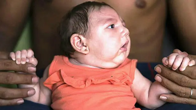 Tim peneliti Universitas PUC-Parana mendapati bukti-bukti baru yang mengaitkan virus Zika dan microcephaly pada bayi.