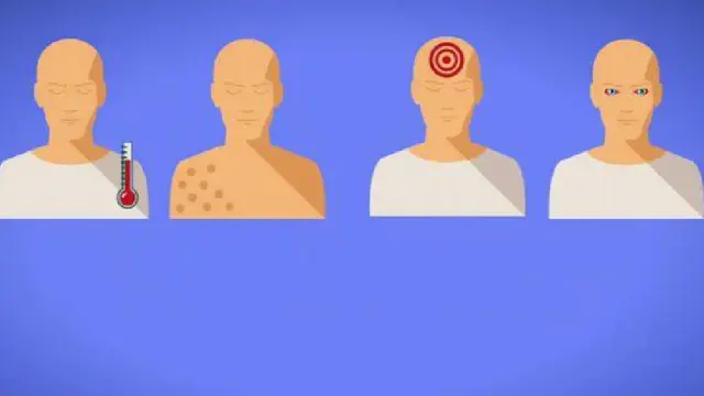 تجرى تجارب متطورة لاكتشاف الفيروس بسرعة.