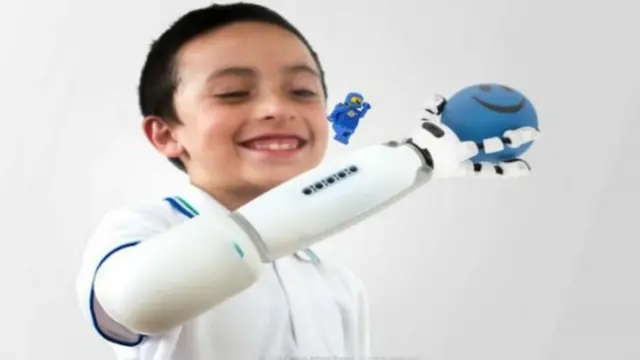 Dario, un colombiano de 8 años cuyo brazo derecho fue amputado, fue el primero en probar el brazo protésico.