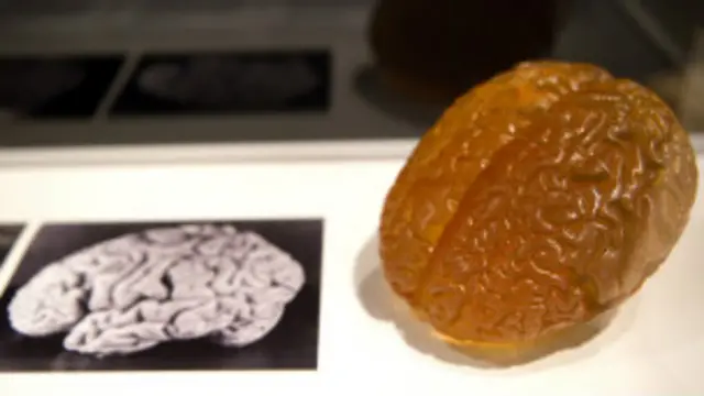 Réplica del cerebro de Einstein.