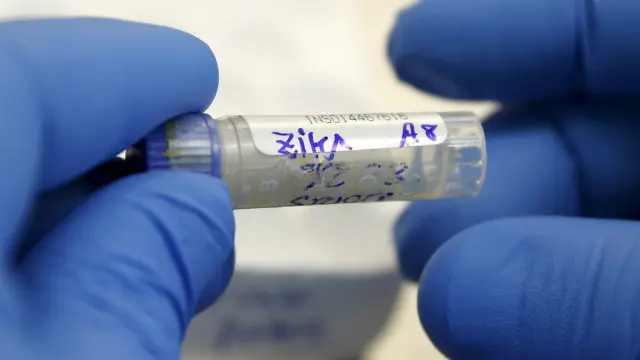 Mẫu máu xét nghiệm zika