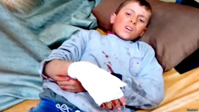 घायल बच्चा