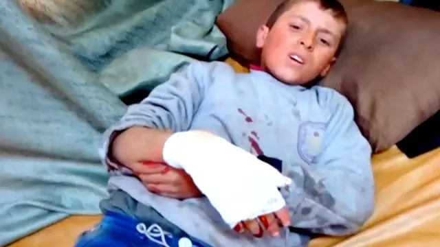 فرانس اور ترکی نے شمالی شام میں ہسپتالوں پر فضائی حملوں کو جنگی جرائم قرار دیا ہے