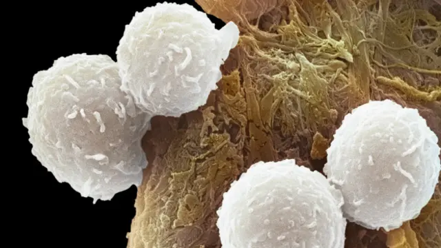 Lösemili kan hücreleri