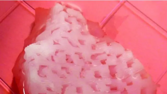 Изготовленный при помощи 3D-принтера недостающий фрагмент сломанной челюсти