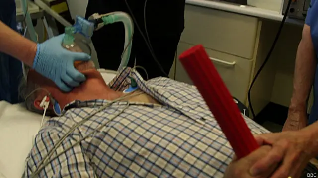 John Wattie, de 64 años, recibió la terapia durante 15 años. 