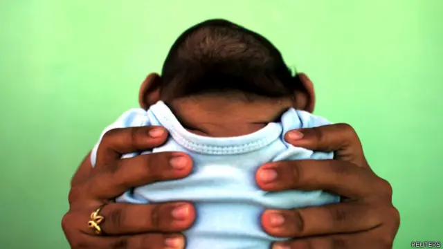 En Brasil se descartó que la microcefalia pueda estar vinculada al uso de larvicidas.