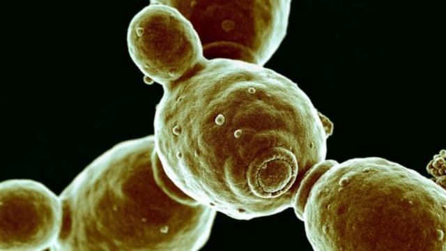  酵母菌感染很不舒服(图片来源：Nano Art Ltd/SPL)