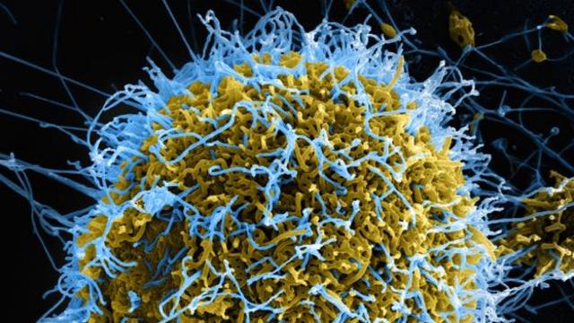 有一种微生物能够降低埃博拉病毒的影响(图片来源：National Institutes of Health/SPL)