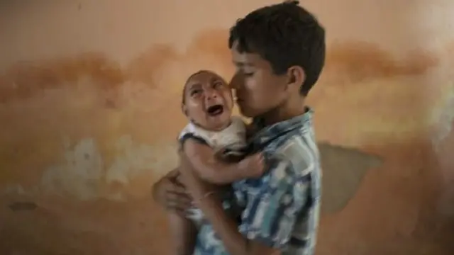 طفل برازيلي يحمل شقيقه الذي ولد مصابا بالمايكروسيفالي