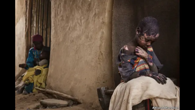 Адриан Оганесян, США, 2015