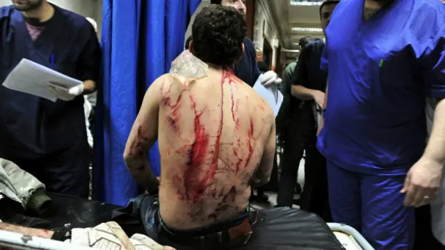 Раненый сириец