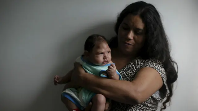 اكدت البرازيل إصابة أكثر من 500 طفل حديث الولادة بصغر حجم الرأس