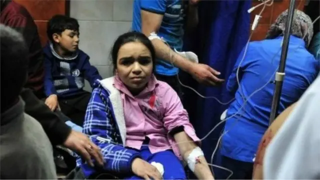 ဒမာ့စကတ်မြို့က ဗုံးခွဲမှုတွေ အတွင်း ဒဏ်ရာရသူ အချို့။