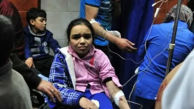 إحدى المصابات في تفجير دمشق