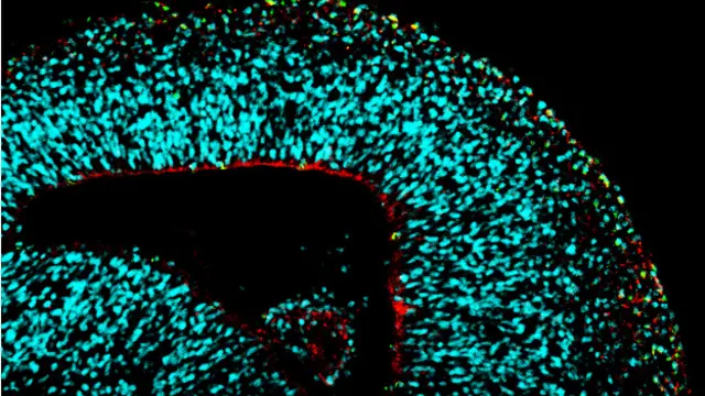 Pesquisa vai mapear danos neurológicos causados pelo zika vírus