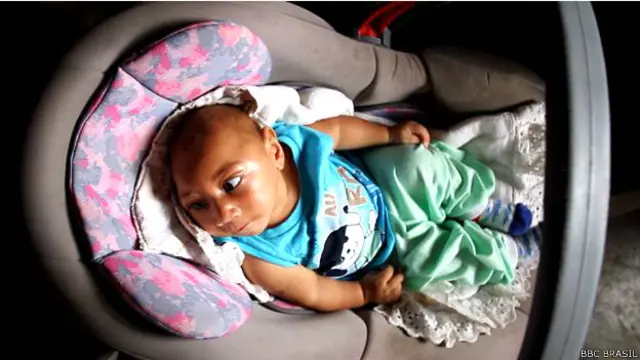 Con cuatro meses, el bebé aún no ha tenido una prueba para medir su visión y audición.