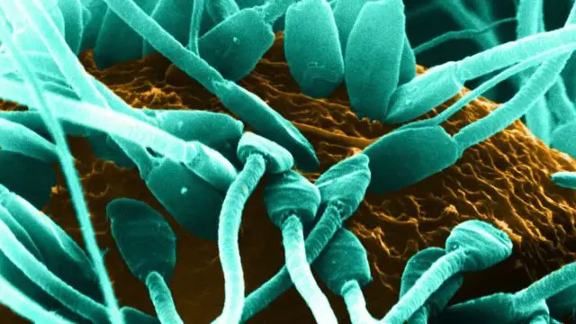 يقول الخبراء إن هذه الدراسة خطوة نحو التوصل لعلاج للعقم