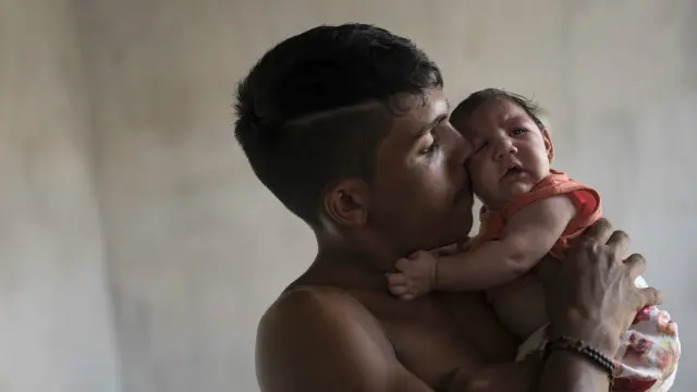 Virus Zika bị cho là có thể gây ra chứng đầu nhỏ ở trẻ sơ sinh 