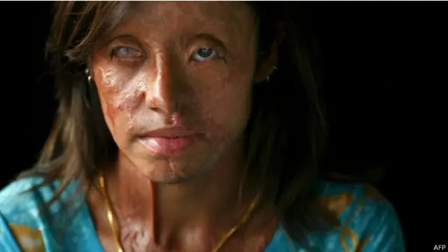 اس سے قبل انھیں تیزاب گردی کے موضوع پر فلم بنانے کے لیے ایوارڈ ملا تھا