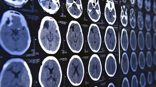 Электрические сигналы мозга