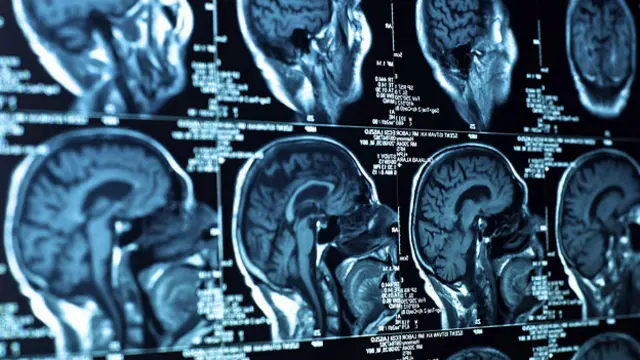 Даже если зависимость между психическим заболеванием и творческой энергией все же существует, причинно-следственная связь между этими явлениями неясна