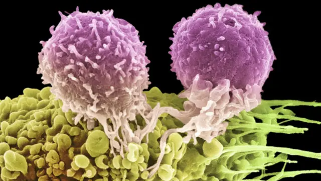 دو سلول T که به تومور حمله کردهاند
