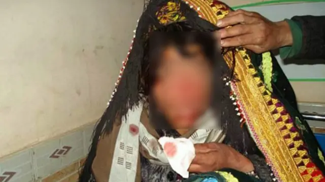 د افغانستان په فارياب ولایت کې له يوې مېرمنې پوزه پرې کړل شوې وه