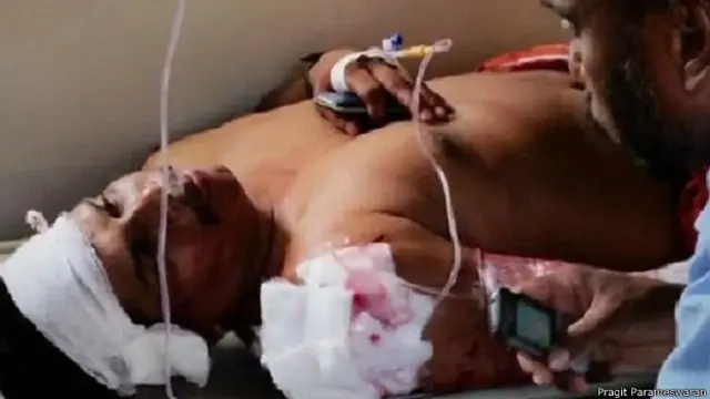 घायल भाजपा कार्यकर्ता पीवी बीजू 