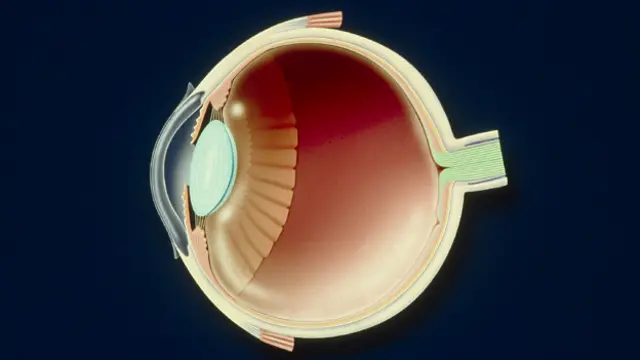 Gráfico de globo ocular 