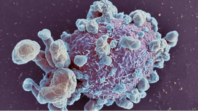 раковая клетка