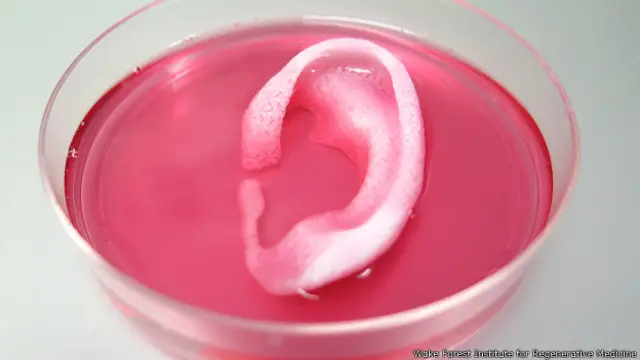 Oreja creada con impresora 3D